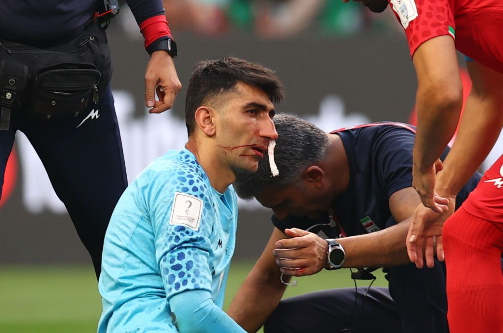 Thủ môn ĐT Iran dính chấn thương kinh dị 2 Thủ môn ĐT Iran dính chấn thương kinh dị 2